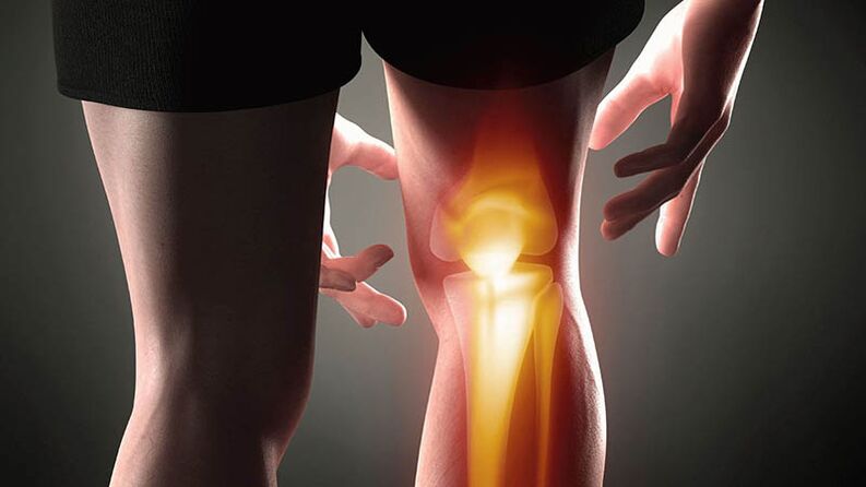 Knee joint osteoarthritis